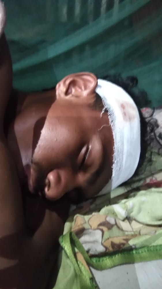 Seorang Pemuda Dilempari Batu dan Dikeroyok! Hingga Kondisinya Kritis