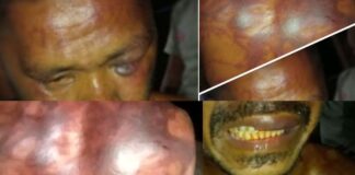 Miris! Ditangkap Tanpa Alasan, Jonikalep Lakarol Diduga Dianiaya Lima Oknum Anggota TNI Didalam Markas Kodim 1622 Alor