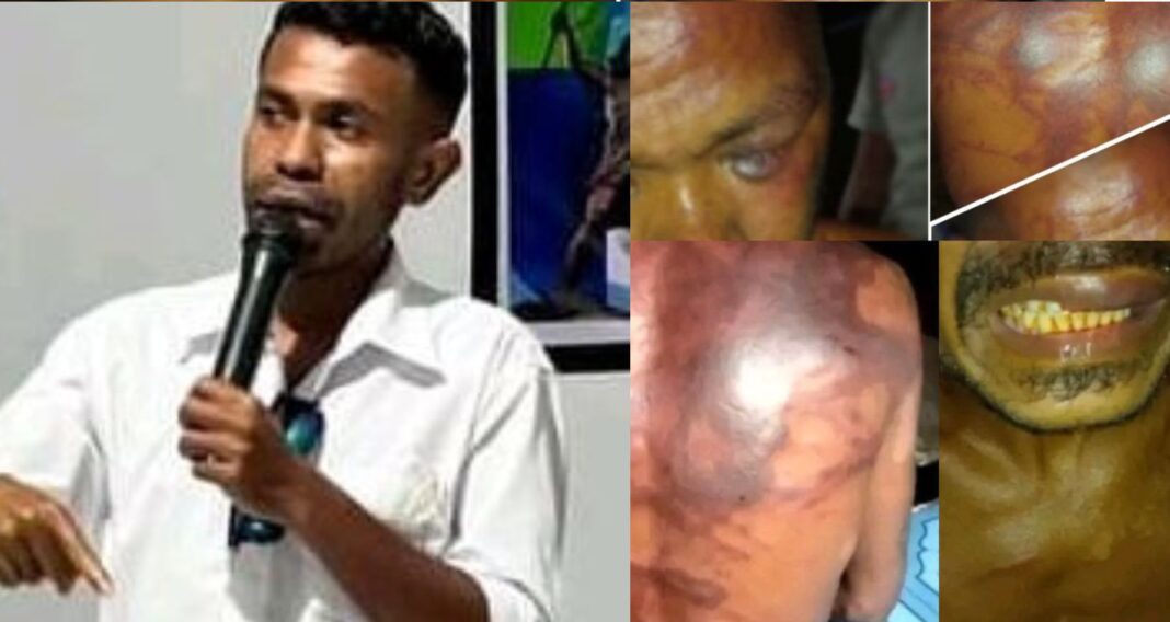 Aktivis Alor Siap Usut Kekerasan Oknum TNI Terhadap Warga Sipil, Erwin Padademang: “Kami Akan Komunikasikan Dengan Danrem 161 Wira Sakti, Polisi Militer Dan Komisi I DPR RI”