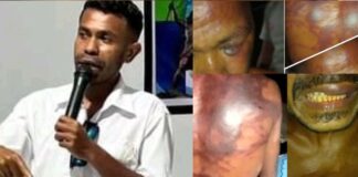 Aktivis Alor Siap Usut Kekerasan Oknum TNI Terhadap Warga Sipil, Erwin Padademang: “Kami Akan Komunikasikan Dengan Danrem 161 Wira Sakti, Polisi Militer Dan Komisi I DPR RI”