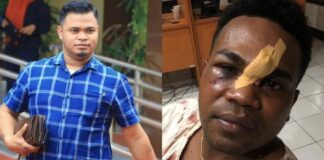 Kuasa Hukum Korban Pemukulan, Sya’ban Sartono Bantah Kapolres Alor: Kapolres Jangan Normalisasi Perbuatan Oknum Anggota, Itu Fatal