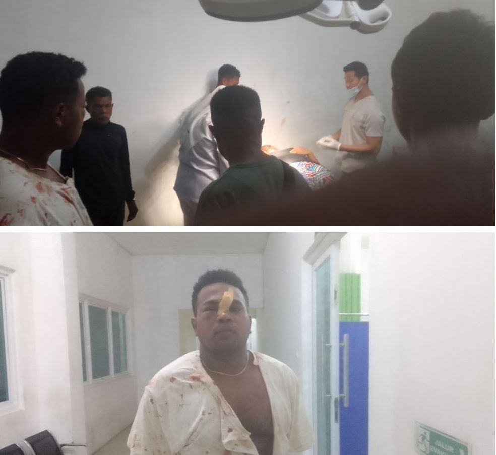 BREAKING NEWS: Oknum Polisi Pukul Ibu Hamil dan Pemuda di Kelurahan Kalabahi Tengah, Korban Kritis di RSUD Kalabahi